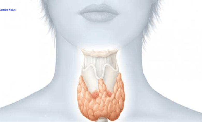 Tips to Manage Hypothyroidism