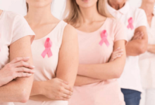 No Radiotherapy On Breast Cancer Patients