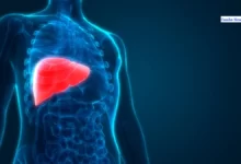 Lifestyle Changes for Liver Diseases